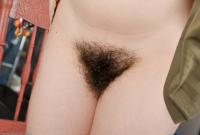 ATK hairy  in mature and hairy