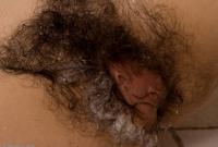 ATK hairy  in mature and hairy