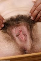 ATK hairy  in mature and hairy