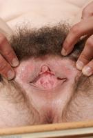 ATK hairy Renee Set