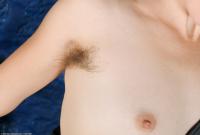 ATK hairy  in mature and hairy