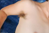 ATK hairy  in mature and hairy