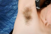 ATK hairy  in mature and hairy