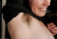 ATK hairy  in mature and hairy