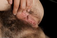 ATK hairy  in mature and hairy