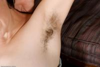 ATK hairy  in mature and hairy