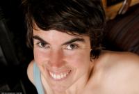 ATK hairy  in mature and hairy