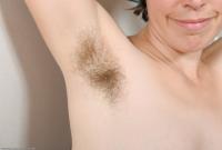 ATK hairy Renee Set
