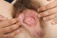 ATK hairy Renee Set