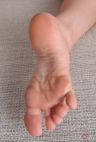 ATK hairy  in young and hairy