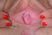 ATK hairy  in young and hairy