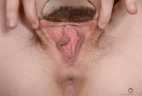 ATK hairy  in young and hairy