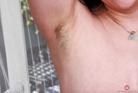 ATK hairy  in young and hairy