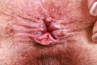 ATK hairy Riley Jean Set