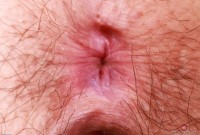ATK hairy  in mature and hairy