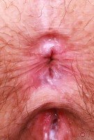 ATK hairy Riley Rose Set