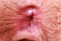 ATK hairy Riley Rose Set