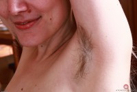 ATK hairy  in mature and hairy