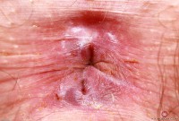 ATK hairy Riley Rose in mature and hairy