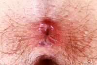 ATK hairy Riley Rose Set