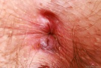 ATK hairy Riley Rose Set