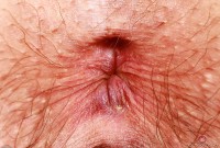 ATK hairy Riley Rose Set