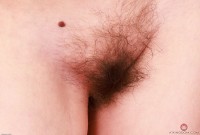 ATK hairy  in mature and hairy