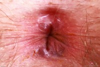 ATK hairy Riley Rose Set