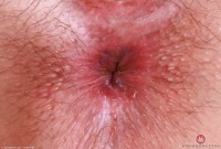 ATK hairy Riley Rose Set