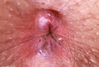 ATK hairy Riley Rose Set