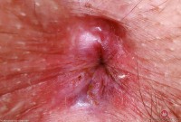 ATK hairy Riley Rose in mature and hairy