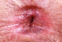 ATK hairy Riley Rose Set