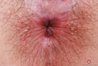 ATK hairy Riley Rose Set