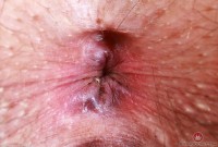 ATK hairy Riley Rose in mature and hairy