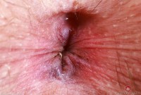 ATK hairy Riley Rose Set