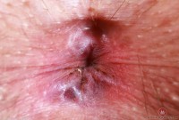 ATK hairy Riley Rose in mature and hairy
