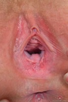 ATK hairy Rococo Royalle Set