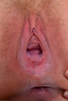 ATK hairy  in young and hairy