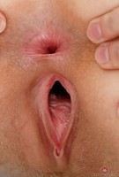 ATK hairy Rococo Royalle Set