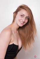 ATK hairy  in young and hairy