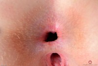 ATK hairy Rococo Royalle Set