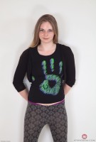 ATK hairy  in young and hairy