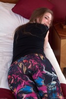 ATK hairy  in young and hairy