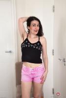 ATK hairy  in mature and hairy