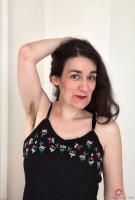 ATK hairy  in mature and hairy