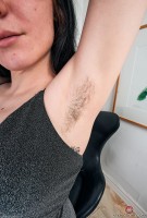 ATK hairy  in young and hairy