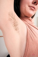 ATK hairy  in young and hairy