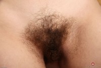 ATK hairy  in mature and hairy