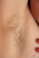 ATK hairy  in mature and hairy