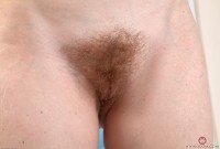 ATK hairy  in young and hairy